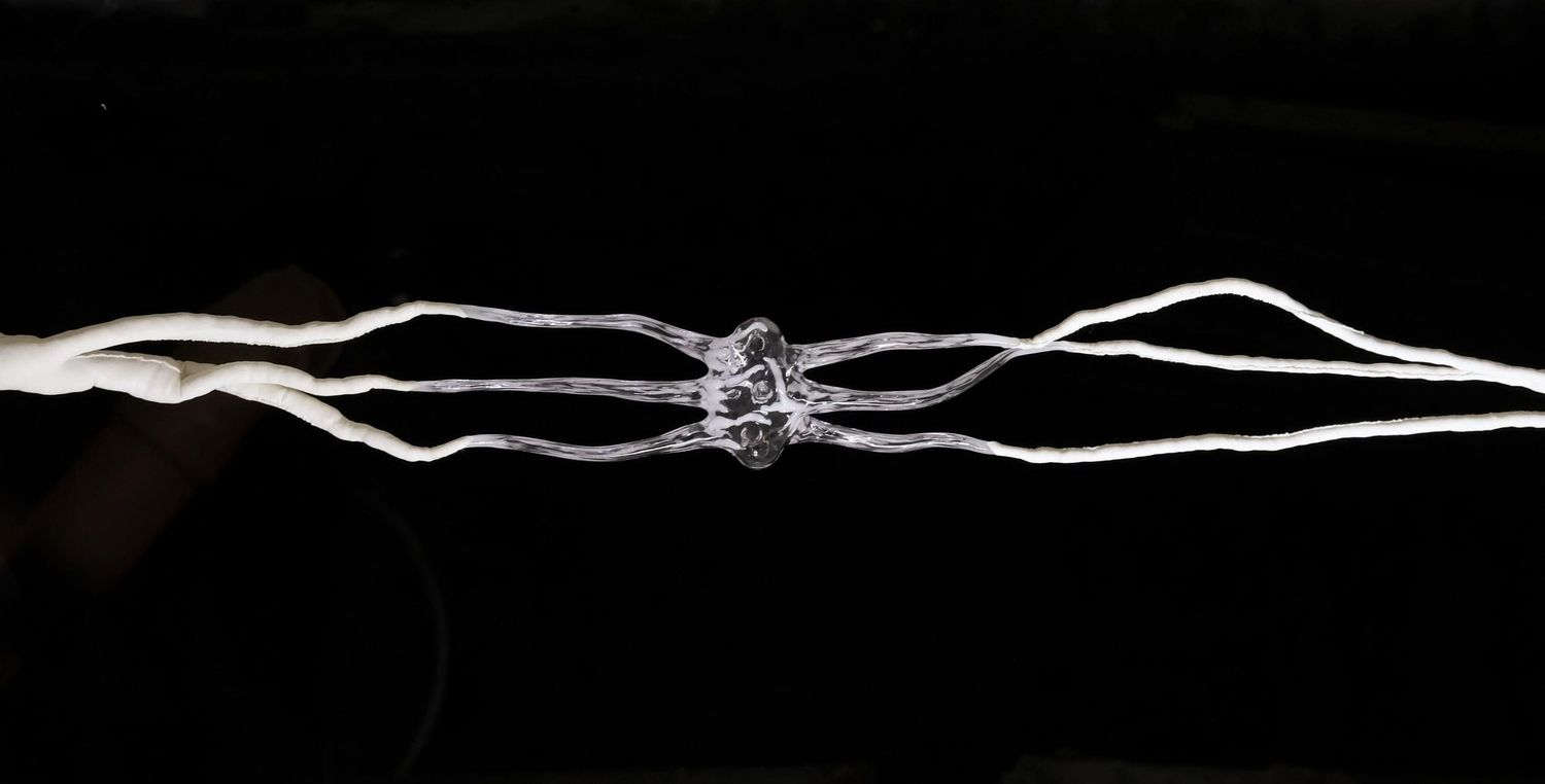 Eszter Metzing – Lymph